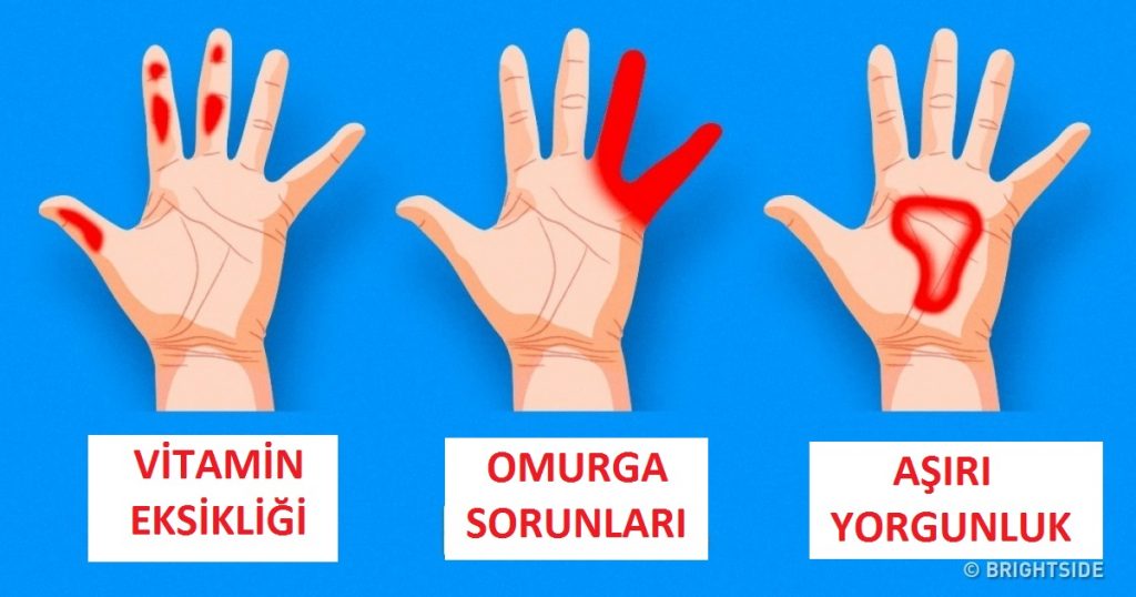 Ellerinizin Sağlığınızla İlgili Verdiği 7 Sinyal