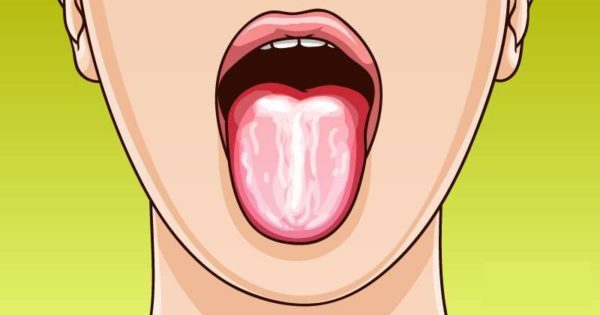 Dilinize Dikkat Edin: Dilinizdeki Değişiklikler Sağlığınız Hakkında Sizi Uyarıyor